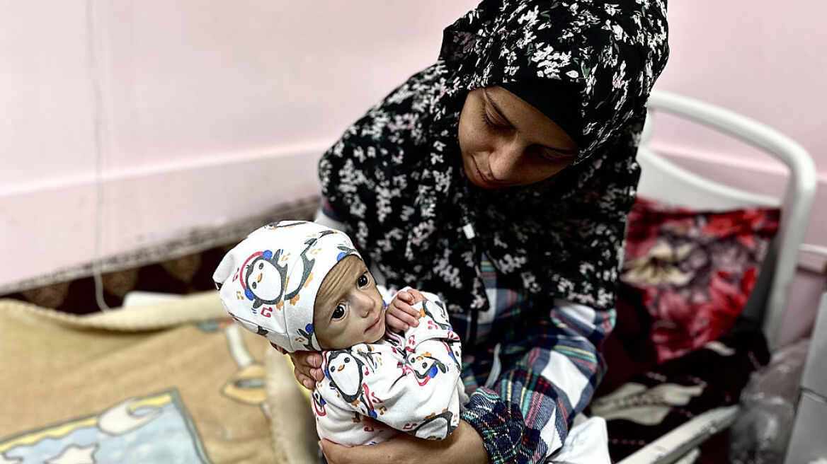 Siwar Ashour: Η φωτογραφία του έξι μηνών μωρού που σόκαρε τον κόσμο