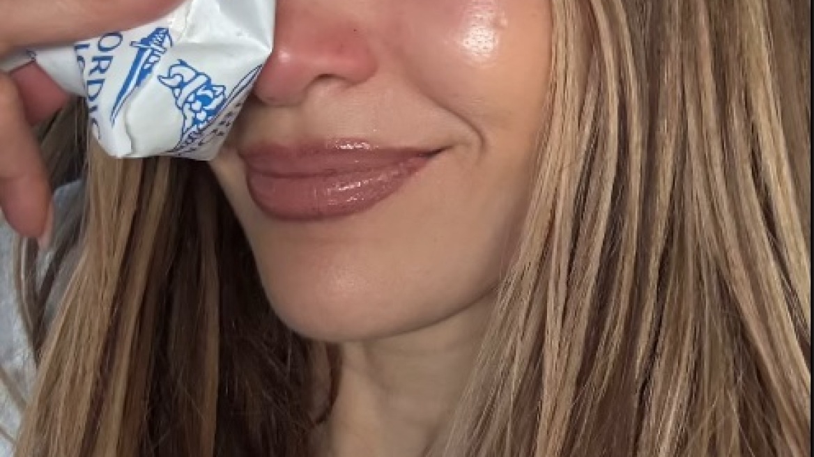 Η Τζένιφερ Λόπεζ με παγοκύστη στο πρόσωπο - Το ατύχημα της τραγουδίστριας και η ανάρρωση (εικόνες)