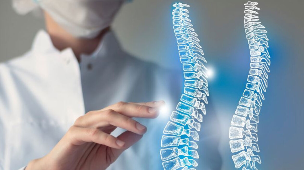 Αντιμετώπιση εφηβικής σκολίωσης με χειρουργική πλοήγηση