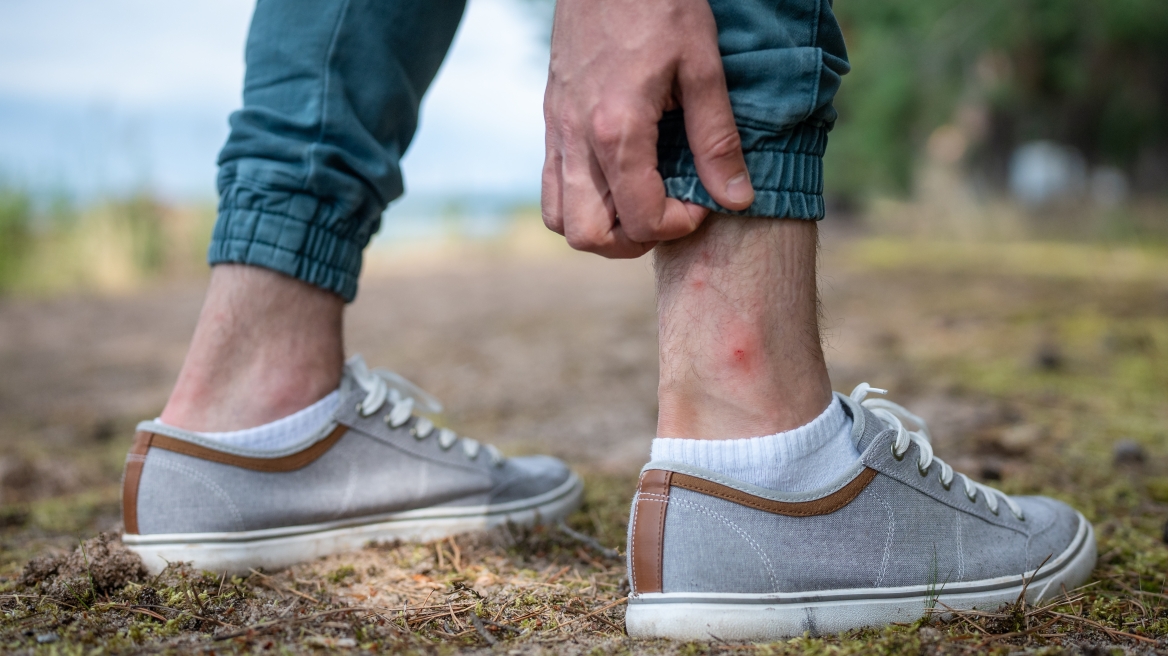 Γιατί τα κουνούπια τσιμπούν μόνο εμένα; Η επιστήμη έχει την απάντηση