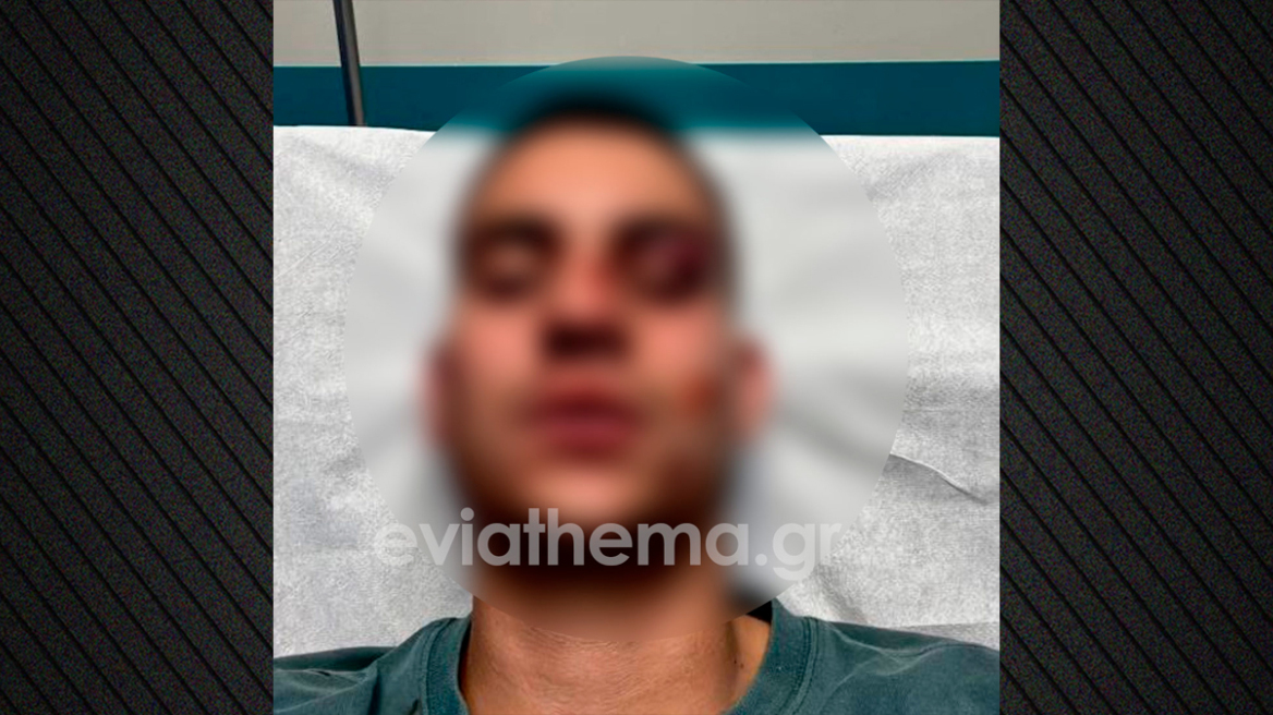 Χαλκίδα: 18χρονος έστειλε στο νοσοκομείο με κάταγμα 19χρονο επειδή έκανε like στη σύντροφό του