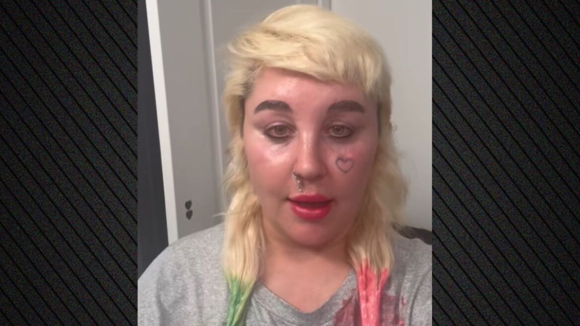 Η Αμάντα Μπάινς ανακοίνωσε ότι θα κάνει χρήση Ozempic  - Ζυγίζει 173 κιλά και ελπίζει να φτάσει στα 130