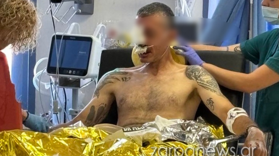 Κρήτη: Σοκαριστικός τραυματισμός του πρωταθλητή ποδηλάτη Γιάννη Ζεντέλη στα Χανιά - Έπεσε σε λακκούβα στον δρόμο της Αγιάς