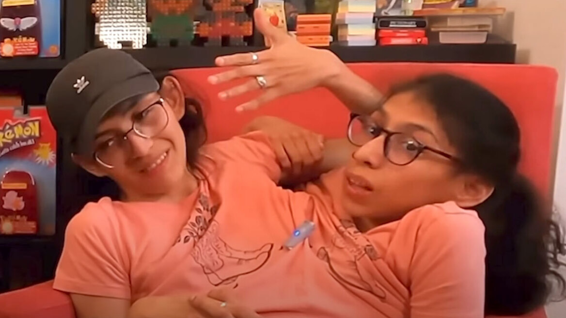 Σιαμαίες έκαναν γάμο αλλά παντρεύτηκε μόνο η μία: Η ιστορία που έγινε viral