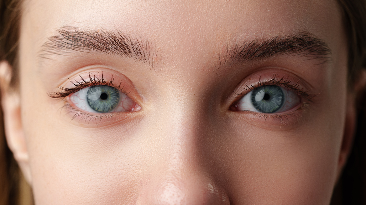 Το πιο σπάνιο χρώμα ματιών στον κόσμο και γιατί δεν το έχουμε δει σχεδόν ποτέ