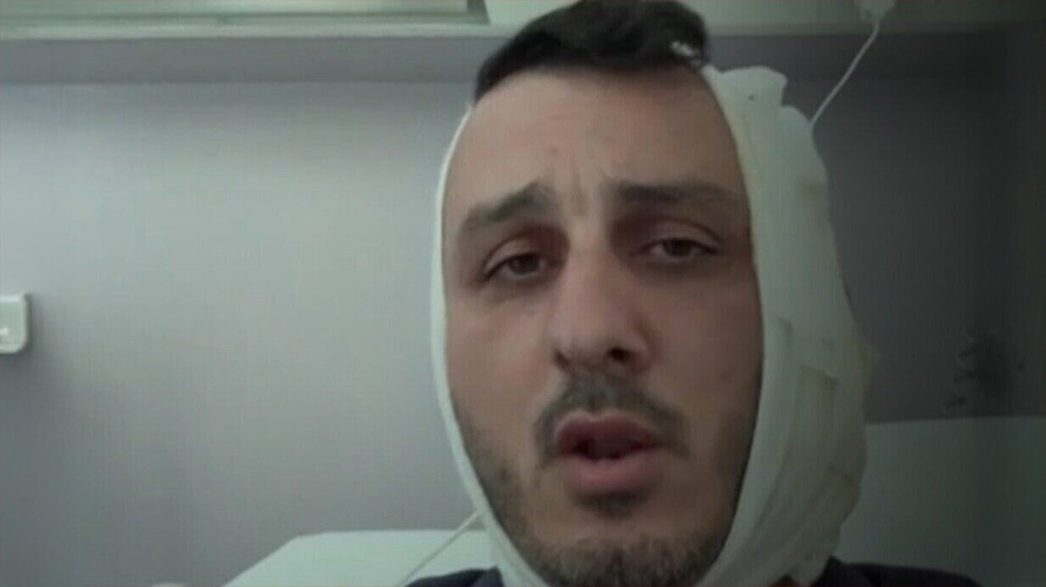 Μου δάγκωσε το αυτί, φώναζε «είμαι Χαμάς», λέει ο Ισραηλινός για τη συμπλοκή με Σύρο σε beach bar στον Άλιμο