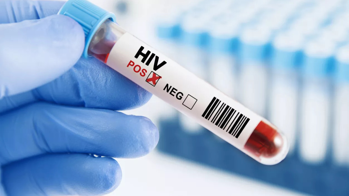 Λοίμωξη HIV-AIDS: Λιγότερα τα νέα περιστατικά, αλλά περισσότερα όσα καθυστερούν να διαγνωστούν
