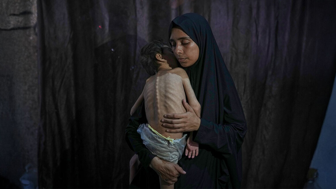 Κραυγή αγωνίας από γονείς στη Γάζα: Αργοπεθαίνουμε, τα παιδιά μας είναι μόνο δέρμα και κόκκαλα...