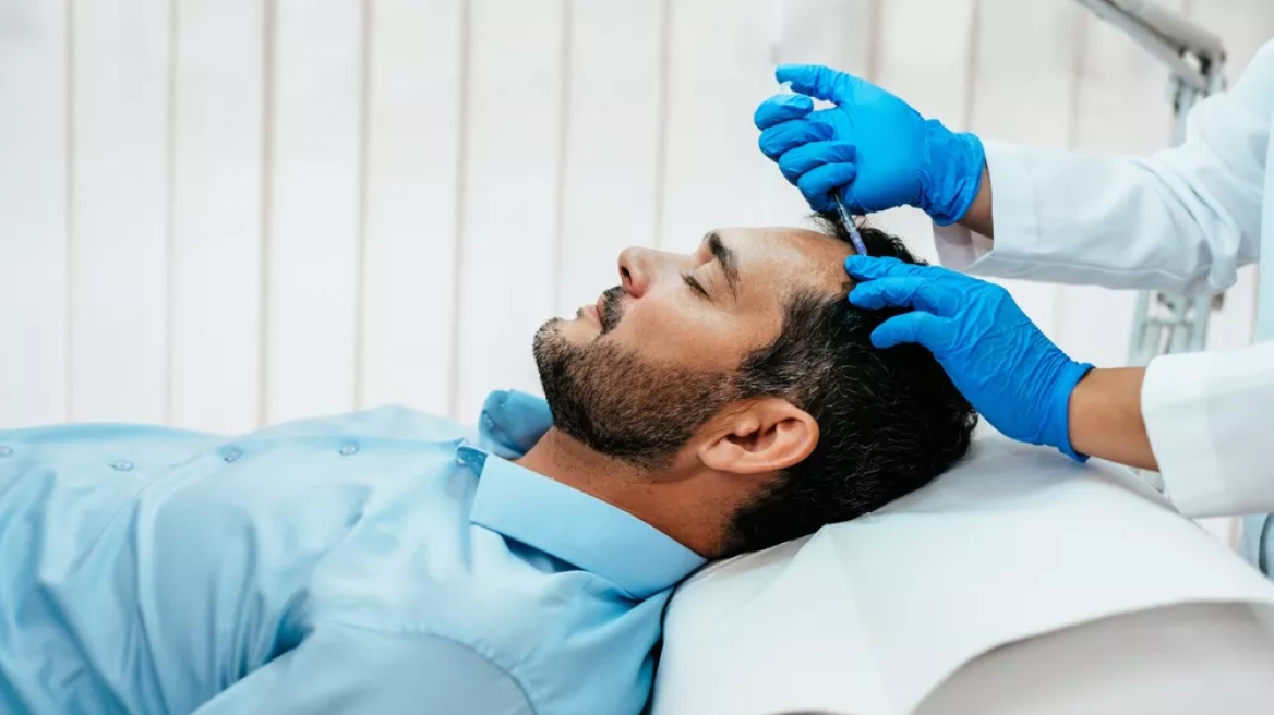 Μεταμόσχευση μαλλιών – Τουρκία: 38χρονος άνδρας πέθανε κατά την προεγχειρητική προετοιμασία