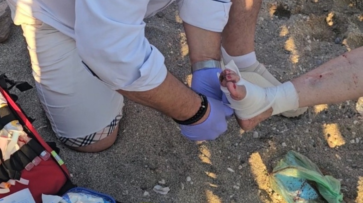 Θαλάσσια χελώνα επιτέθηκε σε λουόμενη σε παραλία της Αναβύσσου - Την τραυμάτισε σοβαρά στο πόδι