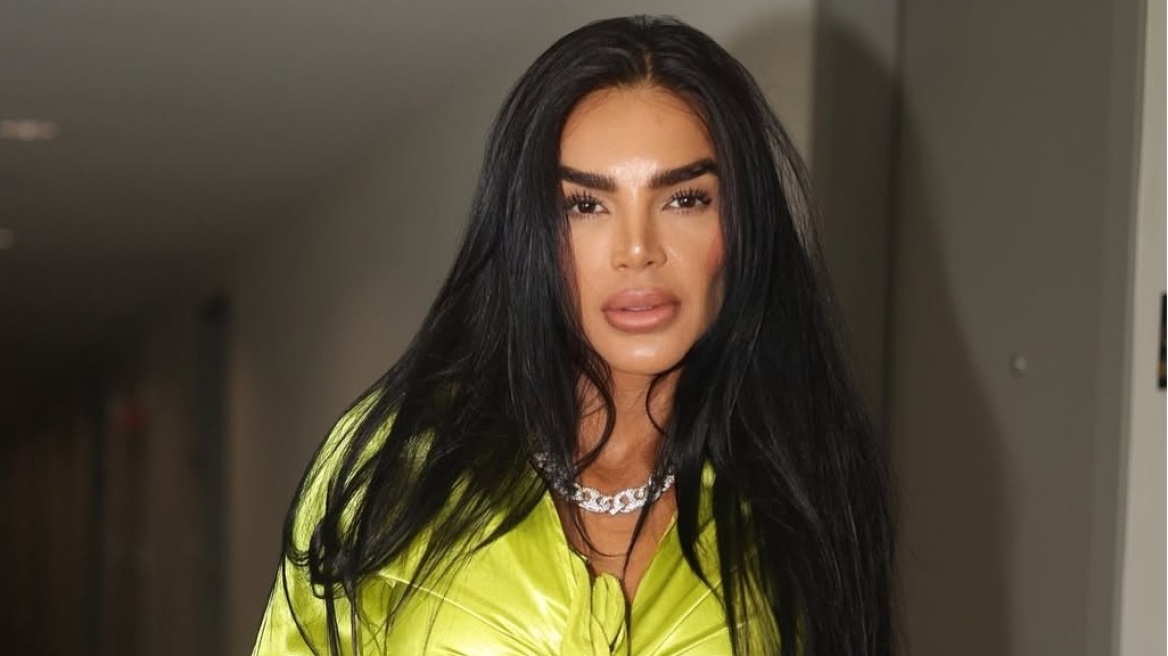 Τρομακτική μεταμόρφωση για μοντέλο από τη Βενεζουέλα: Φοράει κορσέ 23 ώρες την ημέρα και μείωσε 50 εκατοστά τη μέση της