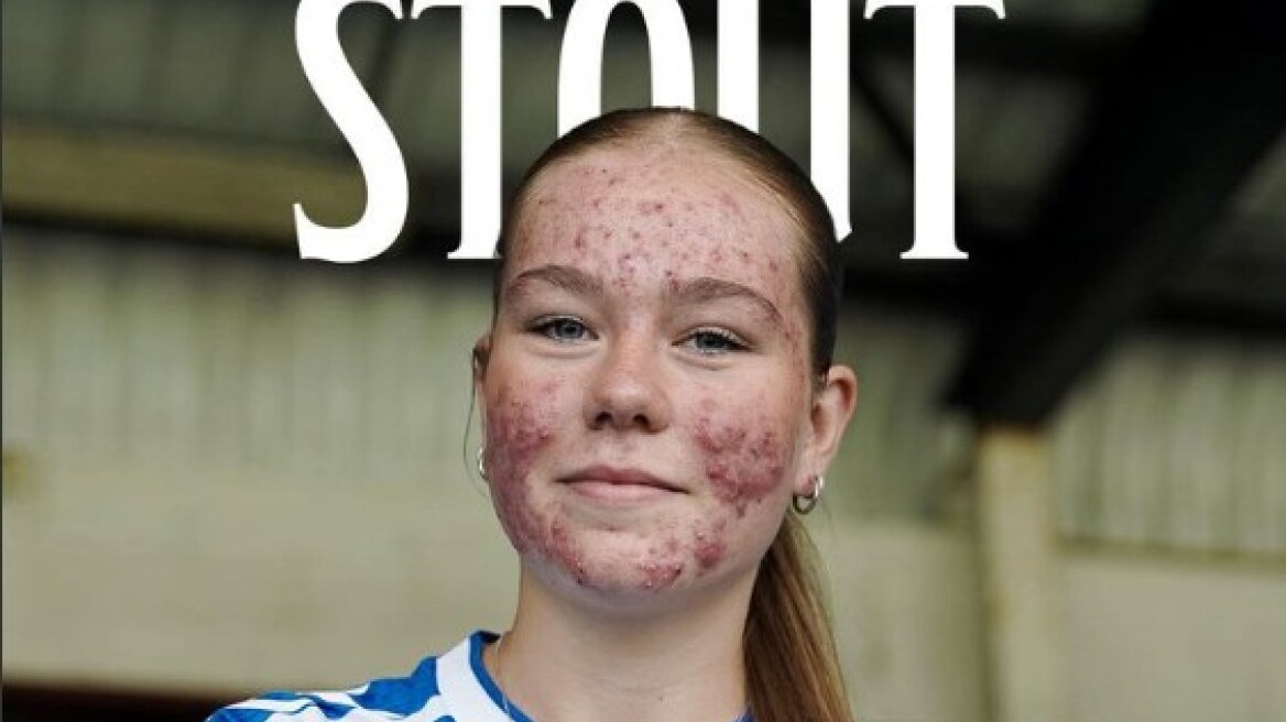 Διαδικτυακό bullying σε 16χρονη ποδοσφαιρίστρια για την εμφάνισή της - Η Κιλμάρνοκ απέσυρε το post της ανακοίνωσής της