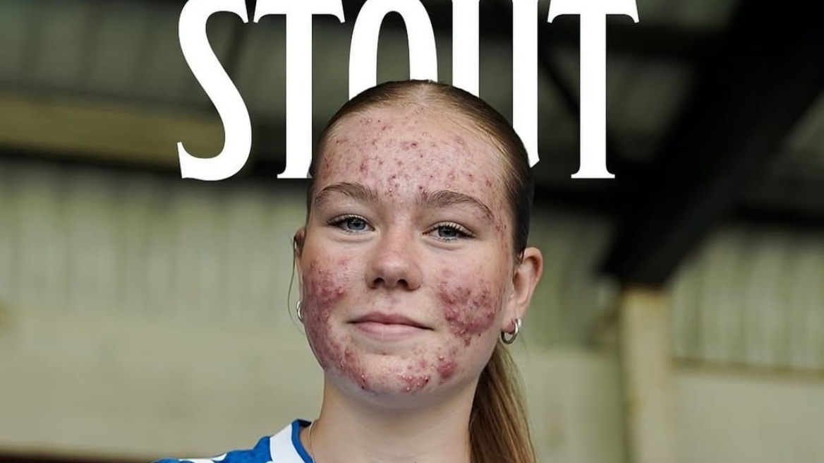 Skye Stout: Η 16χρονη που απάντησε με γκολ στο διαδικτυακό bullying