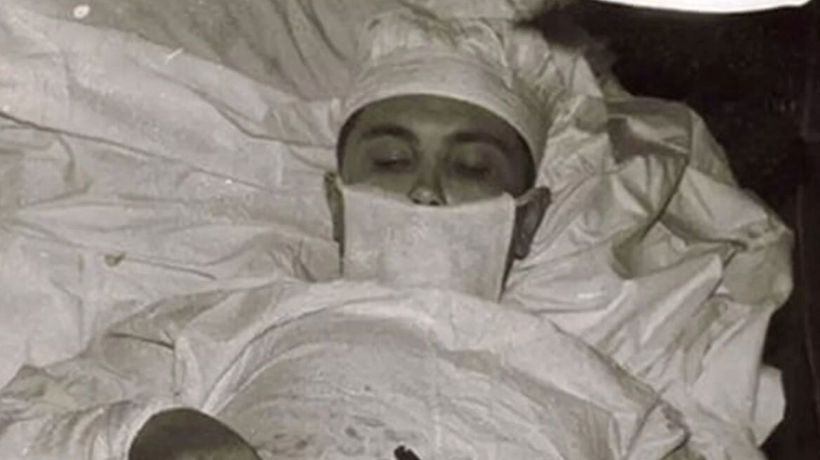 Ο γιατρός που χειρούργησε τον εαυτό του: Η αληθινή ιστορία πίσω από τη φωτογραφία που συγκλονίζει