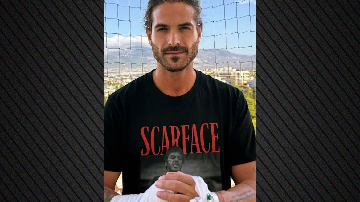 Ο Άρης Μουγκοπέτρος έκανε νέο χειρουργείο στο χέρι του - «Μετά από τέσσερις μήνες είμαι και πάλι στο ίδιο δωμάτιο»