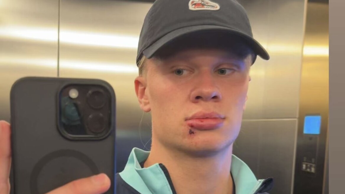 Ο Χάαλαντ «τράκαρε» με την πόρτα του λεωφορείου της Εθνικής Νορβηγίας