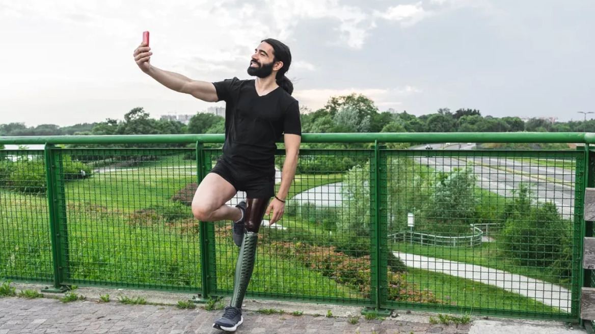 Τεχνητά μέλη – Ακρωτηριασμοί: Ερευνητές αποκαλύπτουν πώς νιώθουμε τα μέλη – φάντασμα