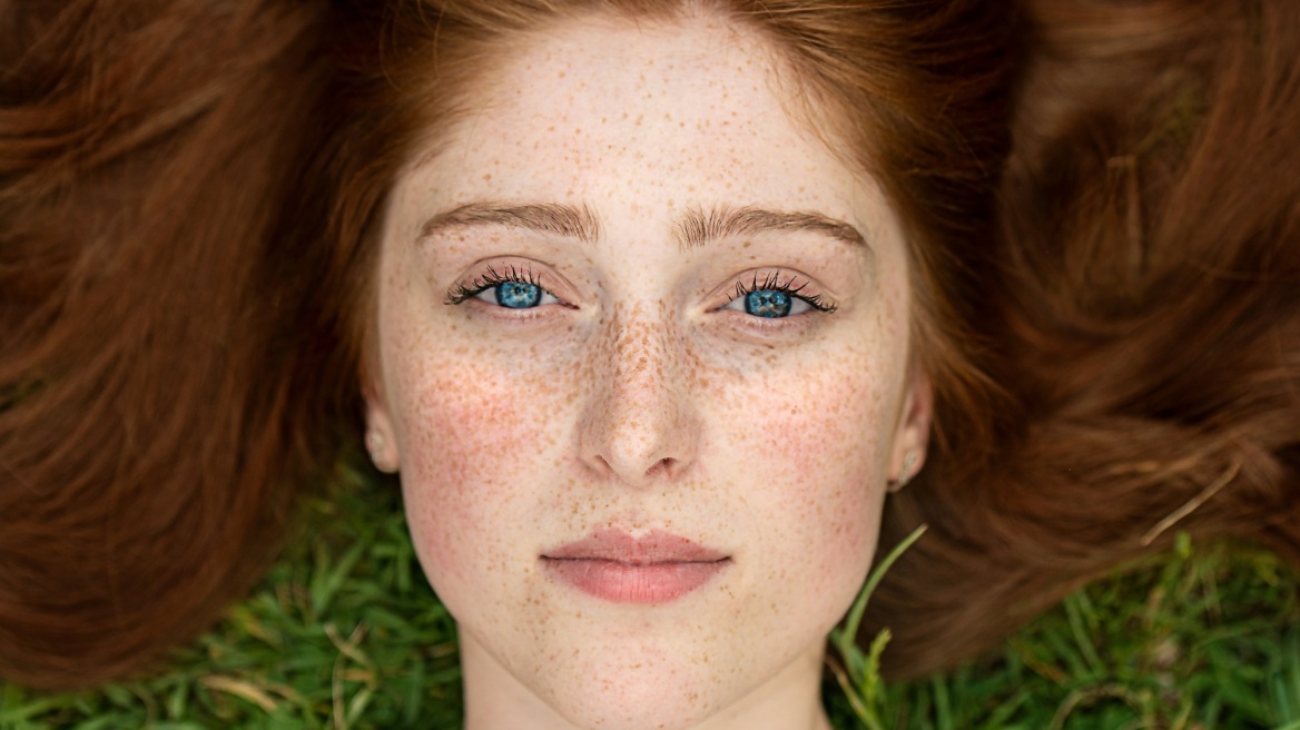 Freckle Pen: Πώς θα πετύχετε φυσικές και απαλές φακίδες
