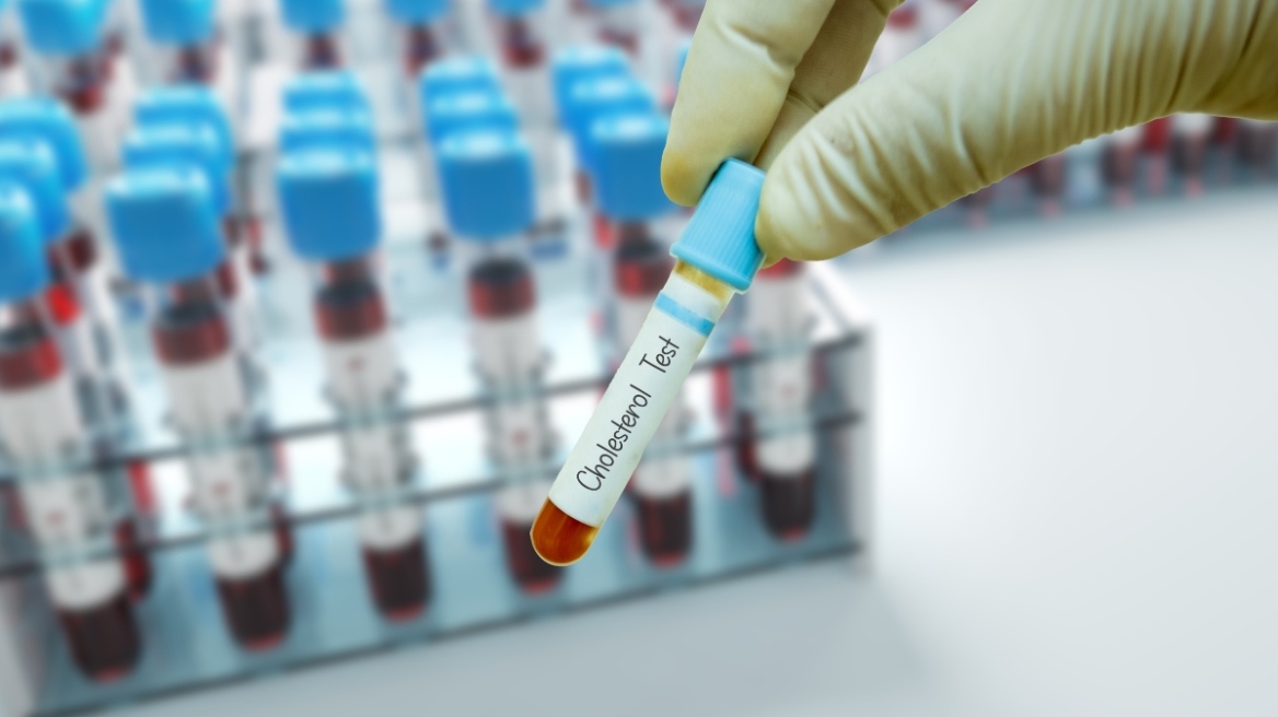 Τρεις νέες συστάσεις για την αντιμετώπιση της χοληστερίνης 