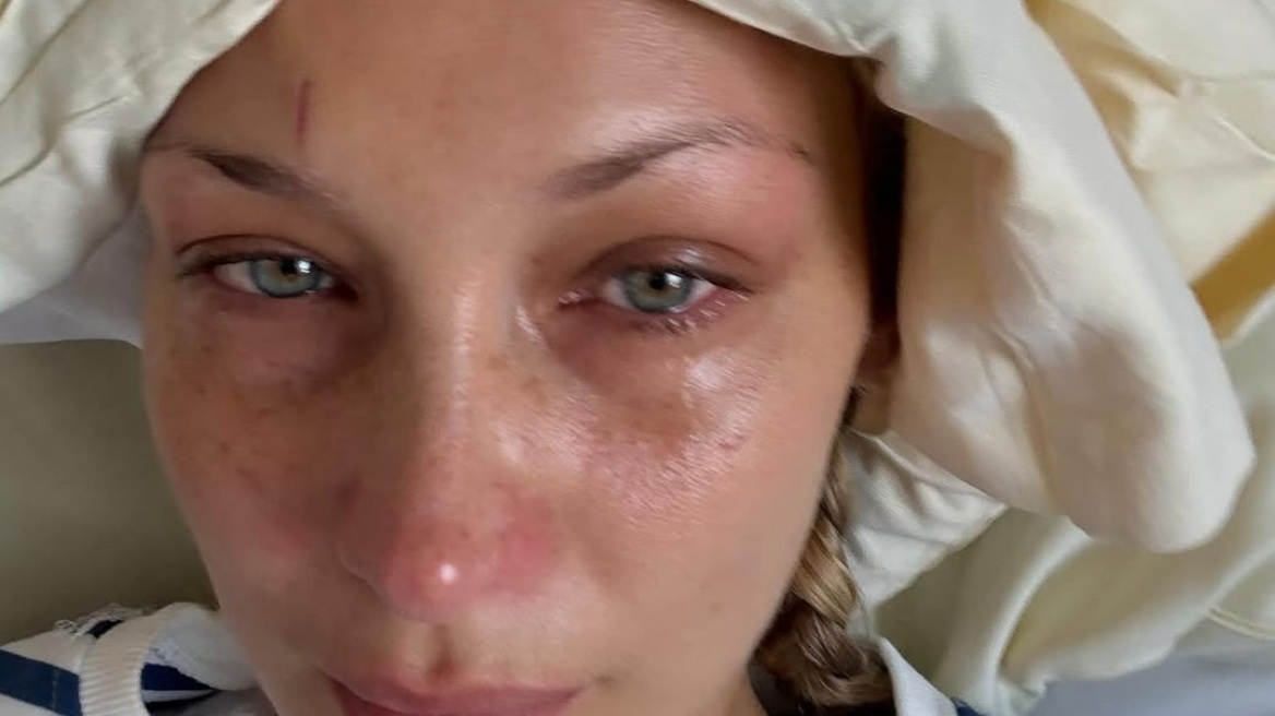 Μπέλα Χαντίντ: Oι φωτογραφίες από το νοσοκομείο, το συγκινητικό μήνυμα της μητέρας της και οι φήμες για ανορεξία