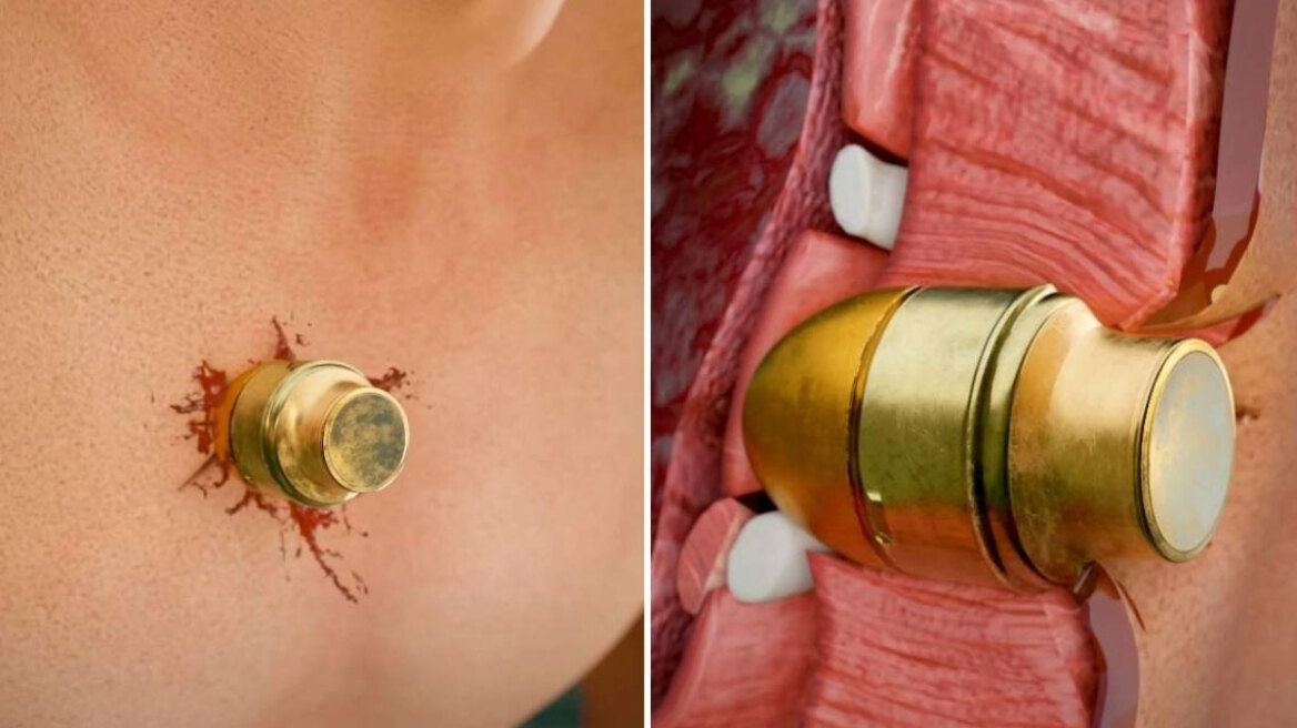 Στρατιώτης επέζησε με χειροβομβίδα στο στήθος του: Προσομοίωση εξηγεί πως τα κατάφερε (vid)
