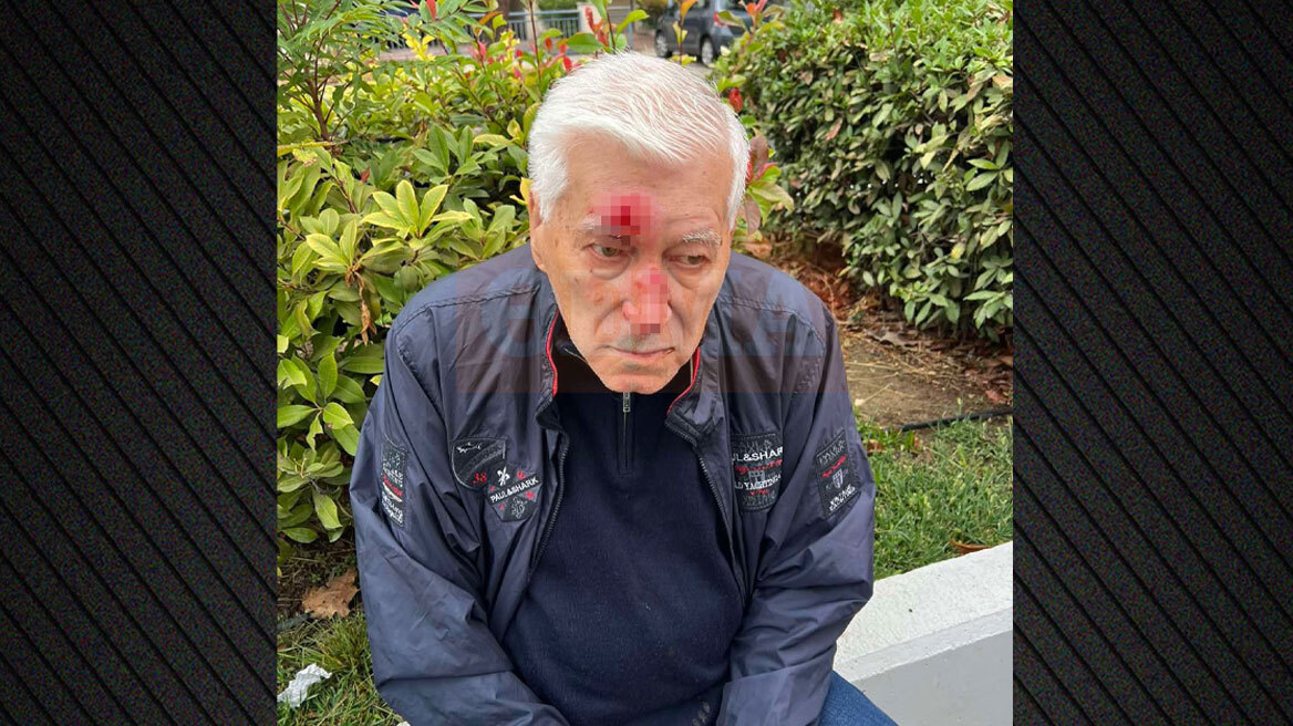 Θεσσαλονίκη: 82χρονος οδηγός κατήγγειλε ότι τον γρονθοκόπησε γιατρός στη μέση του δρόμου - «Μου έριξε δύο μπουνιές και έπεσα κάτω»