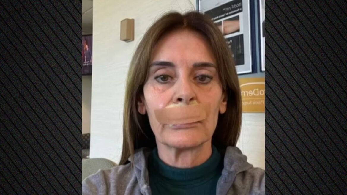 Κατερίνα Πλουμιδάκη: Έκανα την 21η επέμβαση, είμαστε στα μέσα της διαδρομής με τα χειρουργεία