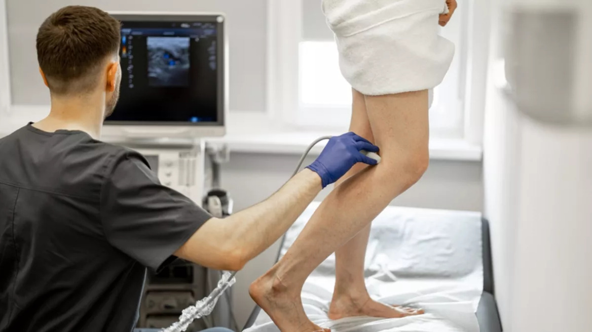 Κιρσοί στα πόδια: Πότε γίνονται επικίνδυνοι – Γιατί πρέπει να χειρουργηθούν
