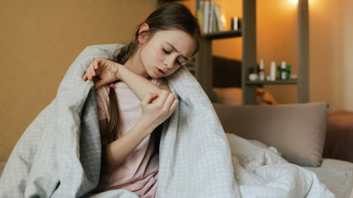 Ψωρίαση: Το διαζύγιο τριπλασιάζει τον κίνδυνο για τα παιδιά
