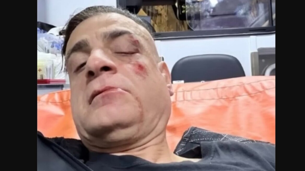 Άγριος ξυλοδαρμός Youtuber στο μετρό της Ρώμης - Του επιτέθηκαν οι πορτοφολάδες που βιντεοσκοπούσε, δείτε βίντεο