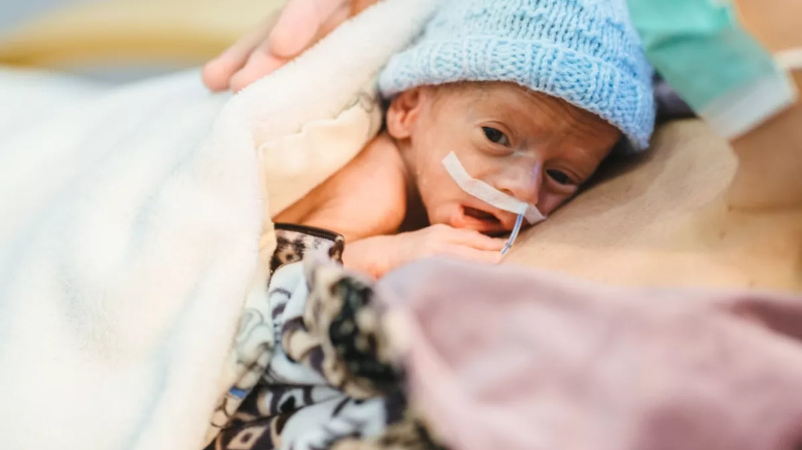 Πρόωρα μωρά: Οι προκλήσεις των πρώτων ημερών για τα μικρά θαύματα που παλεύουν για ζωή
