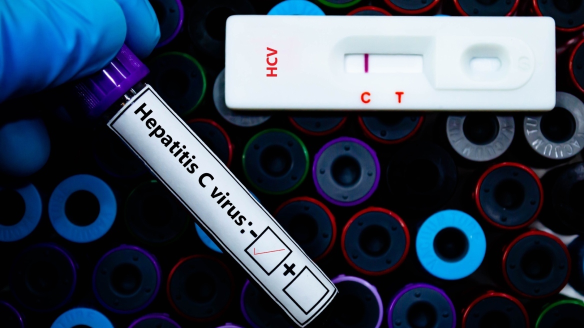 Ηπατίτιδα C: Καινοτόμο rapid τεστ ανιχνεύει τη λοίμωξη μέσα σε 15 λεπτά