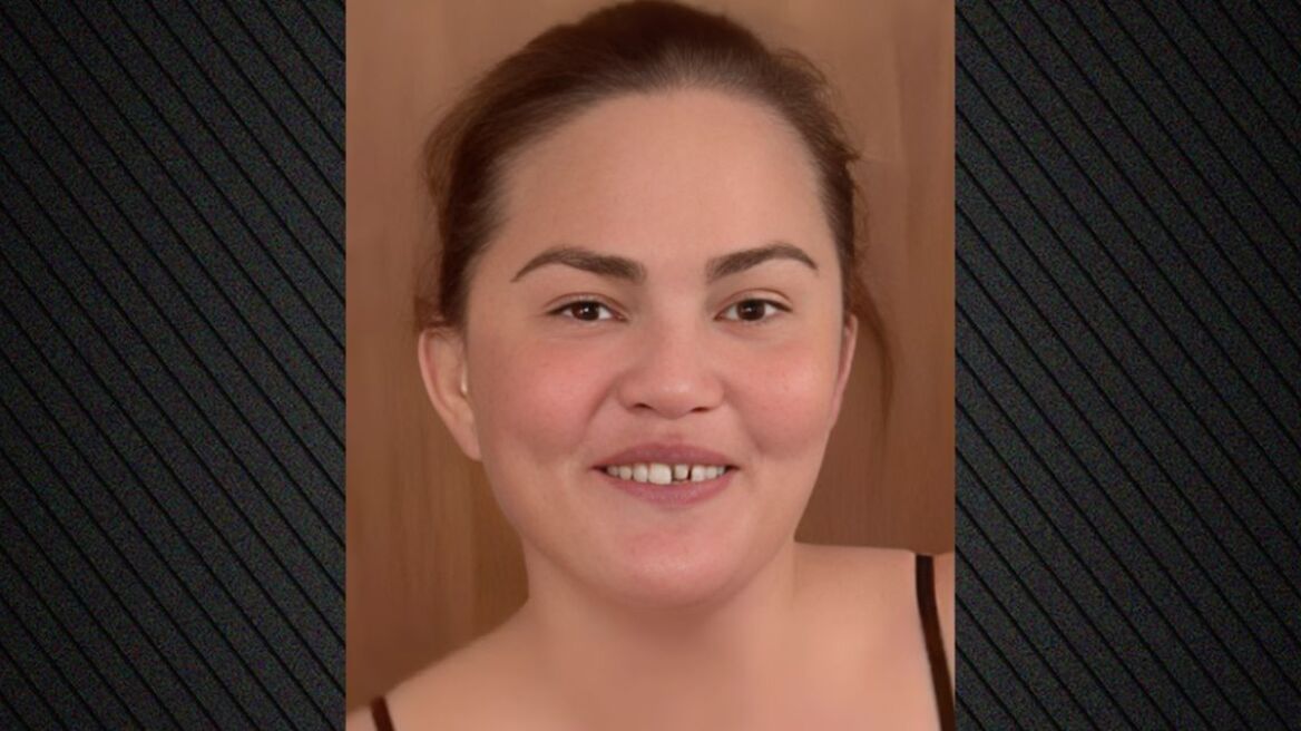 Κρίσι Τέιγκεν: Το μοντέλο έμεινε... χωρίς δόντι: «Αυτά κάνουν οι μαμάδες για τα παιδιά τους»