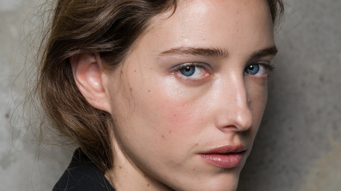 Πανάδες: Γιατί εμφανίζονται και πώς θα τις αντιμετωπίσουμε;
