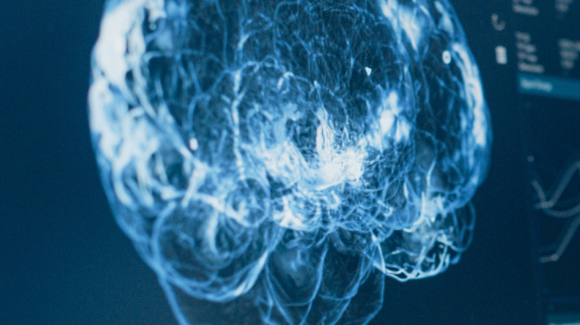 Nevron: Η νευροχειρουργική ομάδα που φέρνει την καινοτομία στο χειρουργείο