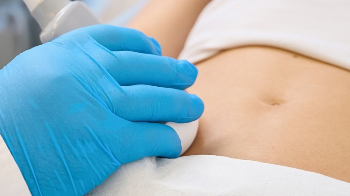 Ανεύρυσμα Κοιλιακής Αορτής: Παράγοντες κινδύνου, συμπτώματα και θεραπεία