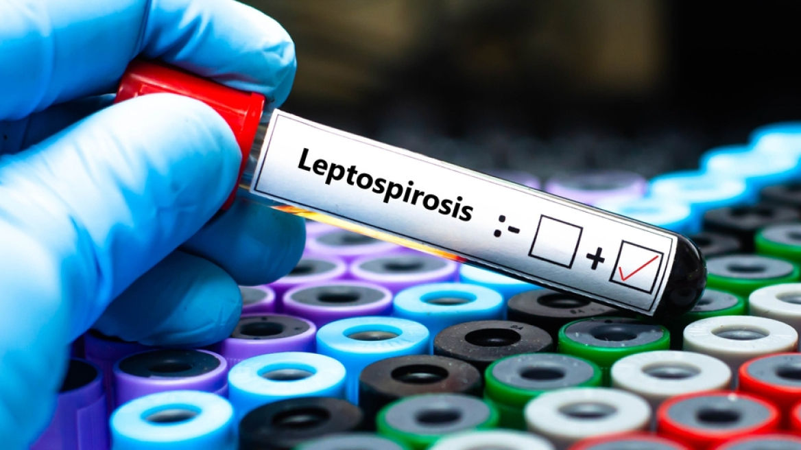 Λεπτοσπείρωση: Τι είναι και πώς μεταδίδεται – Τα συμπτώματα και η αντιμετώπιση