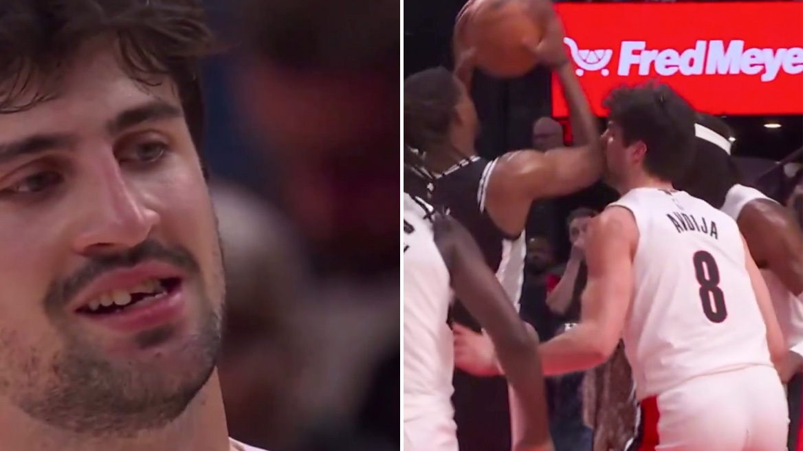 ΝΒΑ: Οι Μπλέιζερς έχασαν το ματς και ο Αβντίγια το δόντι του, δείτε βίντεο