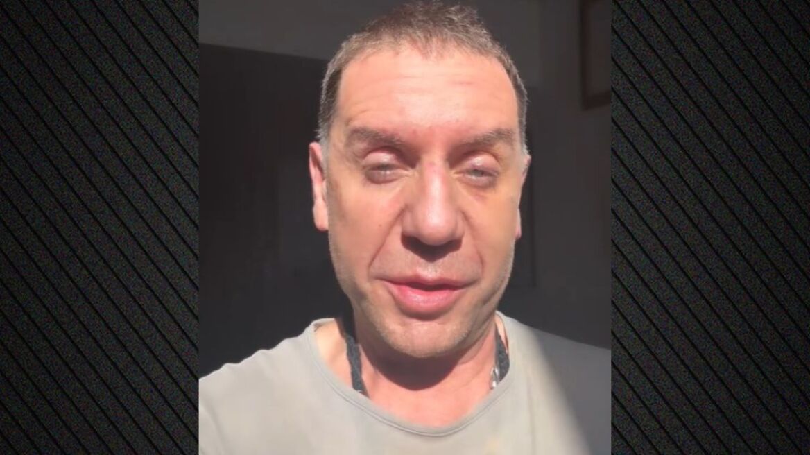 Γιώργος Μαζωνάκης: Μην ξανακούσω κανέναν να λέει ότι δεν θα γίνει η συναυλία μου λόγω του ματιού μου, θα του κόψω το κεφάλι 