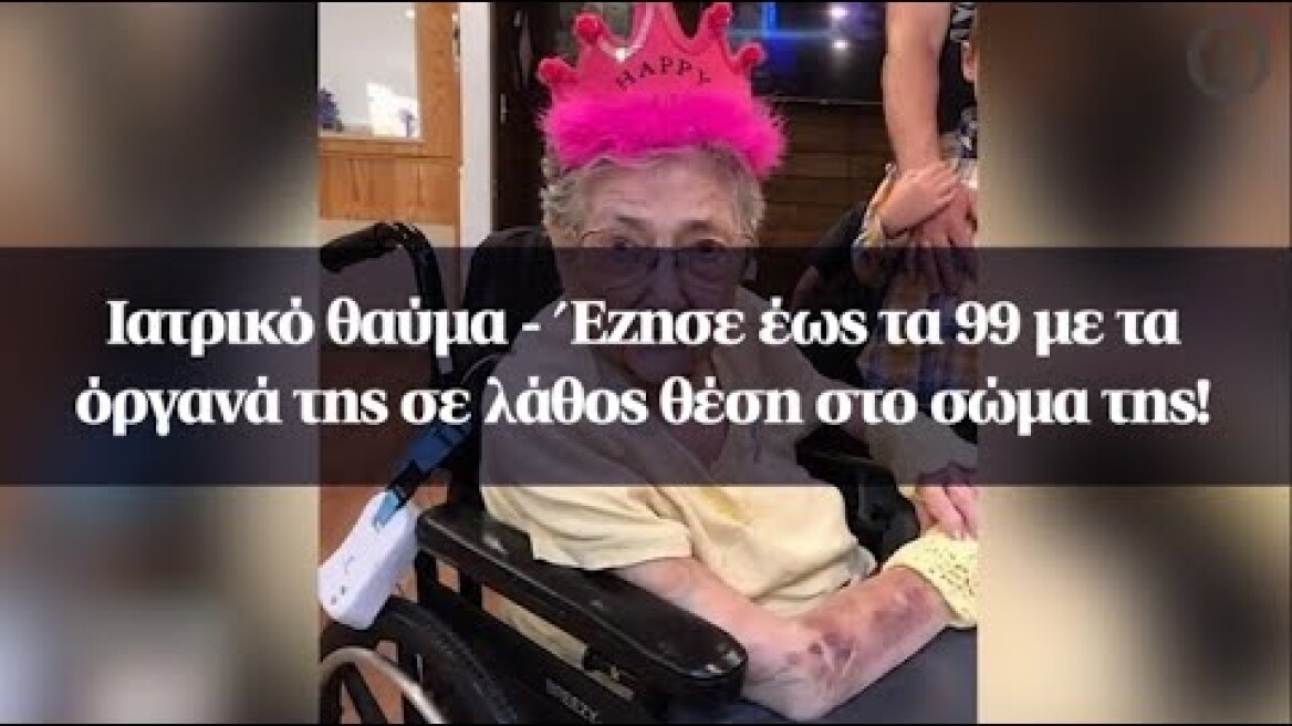 Ιατρικό θαύμα - Έζησε έως τα 99 με τα όργανά της σε λάθος θέση στο σώμα της!