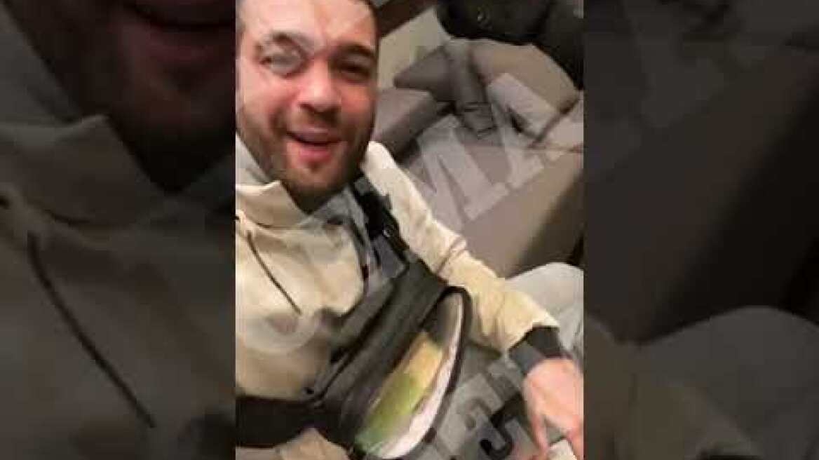 Ο 28χρονος “Γύπας” έκανε μεγάλη ζωή (2)