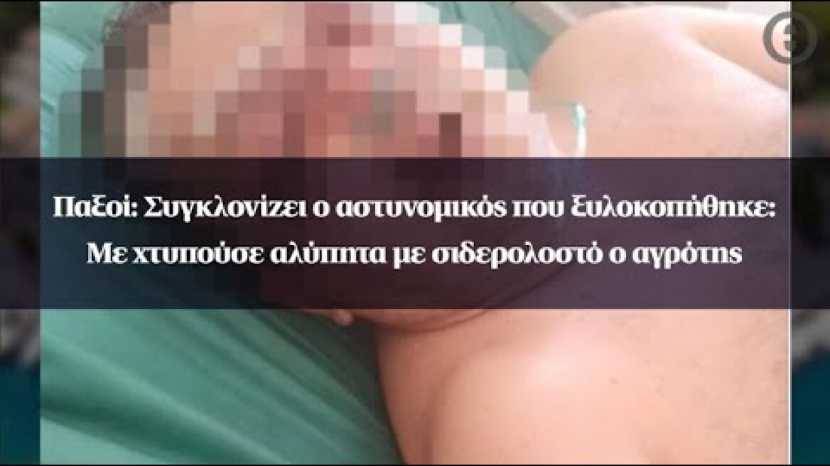 Παξοί: Συγκλονίζει ο αστυνομικός που ξυλοκοπήθηκε: Με χτυπούσε αλύπητα με σιδερολοστό ο αγρότης