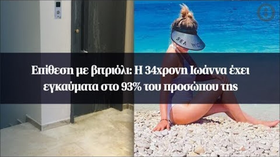 Επίθεση με βιτριόλι: Η 34χρονη Ιωάννα έχει εγκαύματα στο 93% του προσώπου της