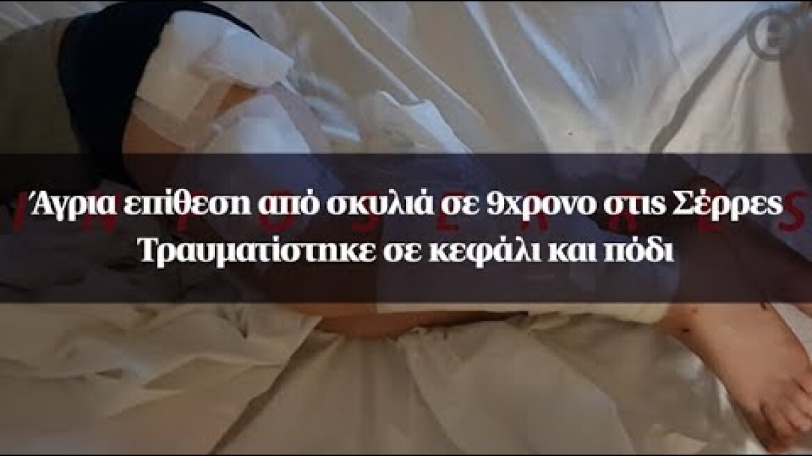 Άγρια επίθεση από σκυλιά σε 9χρονο στις Σέρρες - Τραυματίστηκε σε κεφάλι και πόδι