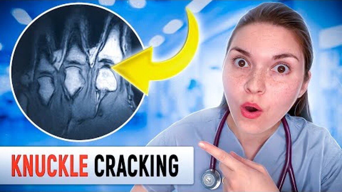 Arthritis Doctor Explains: CRACKING KNUCKLES GOOD or BAD