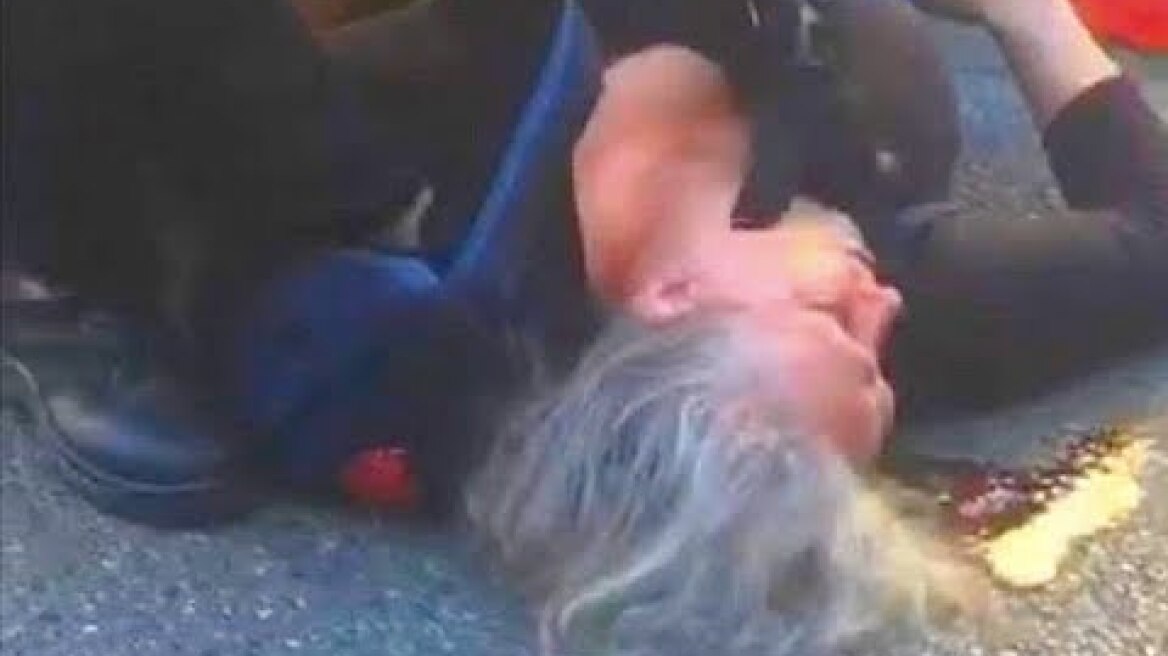 NICE  : Dame âgée grièvement blessée à la tête après une charge des CRS