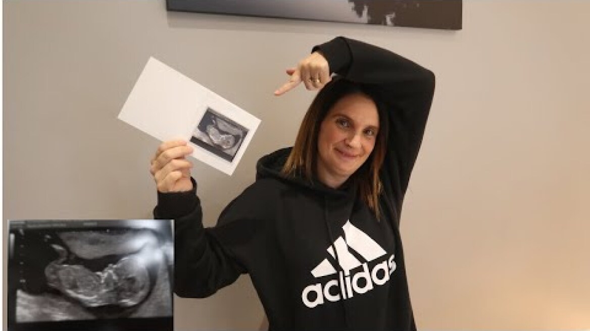 WE'RE HAVING A BABY  !!!!