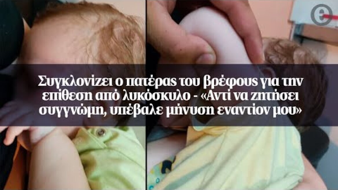 Συγκλονίζει ο πατέρας του βρέφους για την επίθεση από λυκόσκυλο - «Αντί να ζητήσει συγγνώμη...»