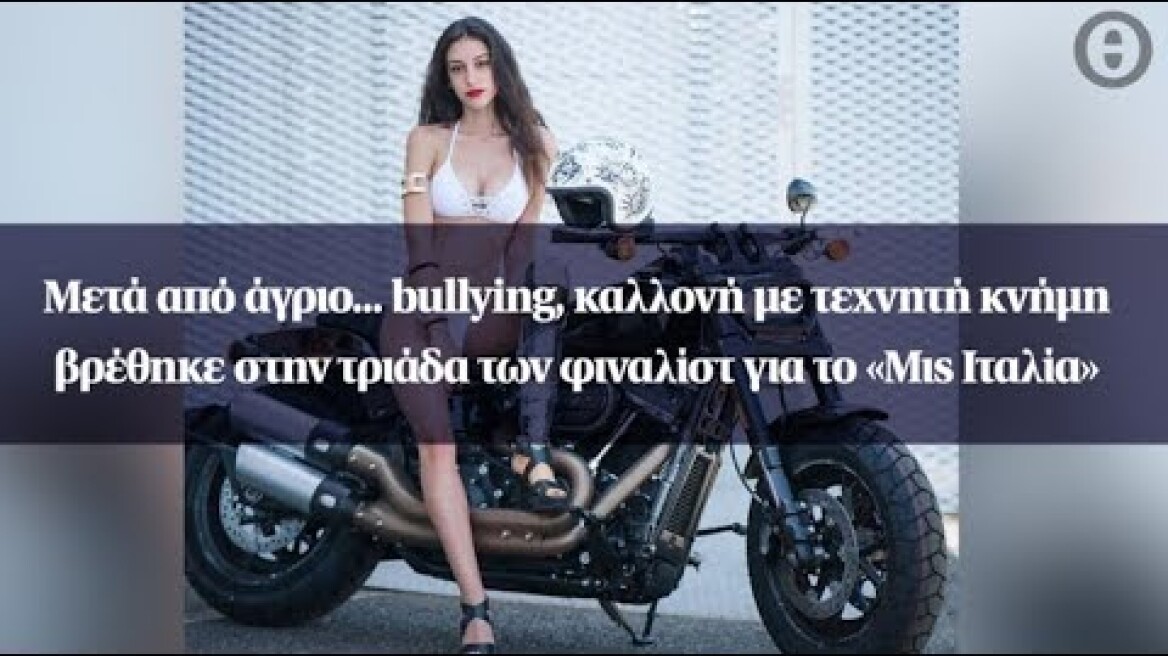 Μετά από άγριο... bullying, καλλονή με τεχνητή κνήμη βρέθηκε στην τριάδα...