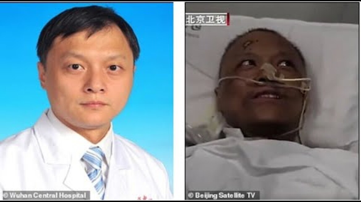 Two Chinese Doctors Turn Black Because Of Coronavirus